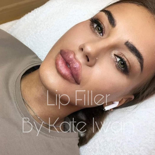 Lip Filler 1ml plus Lumi Eyes